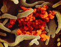 In arancione le particelle virali di SarsCoV2 che emergono da cellule coltivate in laboratorio (fonte: NIAID-RML)  (ANSA)