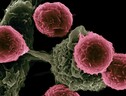  Quando le cellule T combattono un tumore troppo a lungo, finiscono per stancarsi e passare al nemico (fonte: Unsplash) (ANSA)