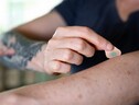 L’applicazione di un cerotto a microaghi per un tatuaggio fai-da-te (fonte: Georgia Tech) (ANSA)
