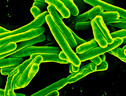 Il Mycobacterium tuberculosis visto al microscopio elettronico (fonte: NIAID) (ANSA)