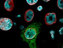 Le cellule tumorali possono passare dallo stato solido a quello liquido, più pericoloso (fonte: IFOM / Università degli Studi di Milano) (ANSA)