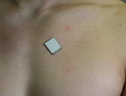 Il sensore non invasivo, indossabile sul torace come un piccolo cerotto delle dimensioni di un francobollo ed estremamente resistente anche ad attività fisica intensa (fonte: Xu Laboratory, UC San Diego Jacobs School of Engineering) (ANSA)