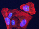 La proteina telomerica VR (sfere verdi) recentemente scoperta si accumula nei nuclei (ovale blu) nelle cellule tumorali dell'osteosarcoma umano colorate in rosso. (Laboratorio Griffith) (ANSA)