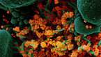 In arancione le particelle del virus SarsCoV2 (fonte: NIAID) (ANSA)