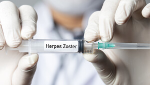 Vaccino herpes zoster (ANSA)