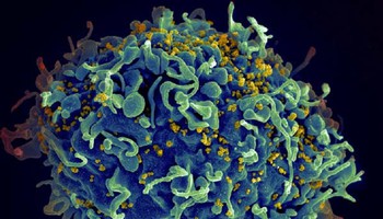 Una cellula umana attaccata dal virus Hiv (fonte: S. Pincus, E. Fischer, A. Athman, NIAID/NIH) (ANSA)
