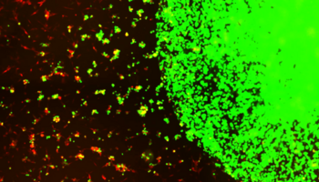 Le cellule staminali modificate (in verde) intercettano e uccidono le cellule tumorali (in rosso) (Fonte: Shah lab (CSTI)) (ANSA)