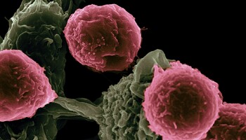 Cellule tumorali (fonte: National Cancer Institute da Unsplash) (ANSA)