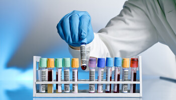 Un test del sangue per scoprire 50 tumori (ANSA)