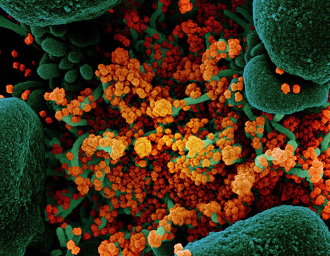 In arancione le particelle del virus SarsCoV2 (fonte: NIAID) (ANSA)