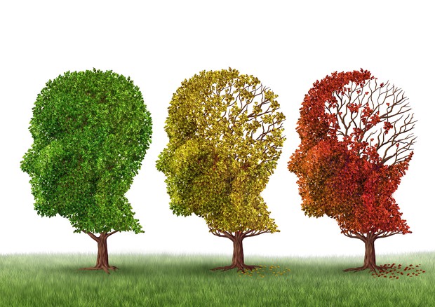 Alzheimer, 200mila italiani destinati ad ammalarsi nei prossimi anni © Ansa