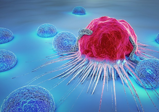 Cellule immunitarie che attaccano un tumore © Ansa