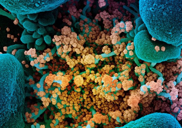 Particelle del virus SarsCoV2nsu una cellula (fonte: NIAID) © Ansa