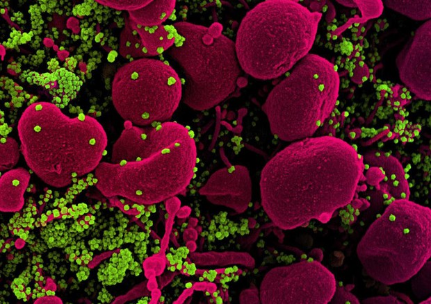 In verde particelle di virus SarsCoV2 sulla superficie di una cellula (fonte: NIAID) © Ansa