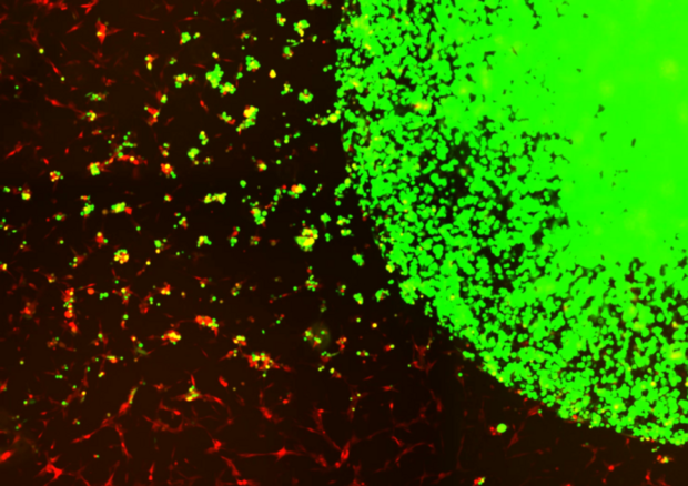 Le cellule staminali modificate (in verde) intercettano e uccidono le cellule tumorali (in rosso) (Fonte: Shah lab (CSTI)) © Ansa