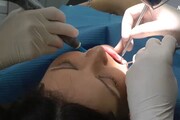 Igiene orale professionale, se eseguita male puo' far danni