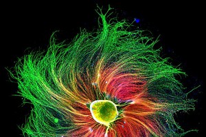 Ganglio di nervi sensoriali in un embrione di ratto. La foto è stata selezionata dalla rivista Nature fra le migliori del 2021 (fonte: Paula Diaz, Pontificia Universidad Católica de Chile/Nikon Small World) (ANSA)