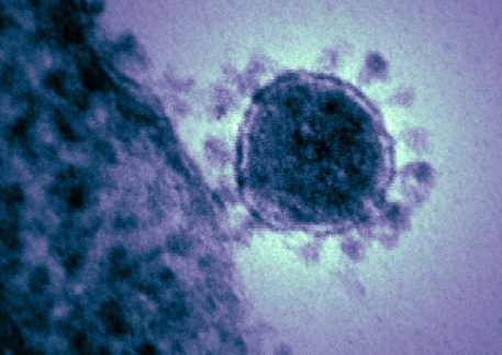 Particella di un coronavis vista al microscopio elettronico (fonte: National Institutes of Health, NIH) © Ansa