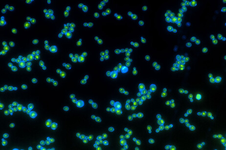 Le proteine di rodopsina in verde all'interno delle cellule di lievito modificate (fonte: Anthony Burnetti, Georgia Institute of Technology)