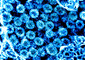 Particelle di coronavirus viste al microscopio eletttronico (fonte: NIAID) © ANSA