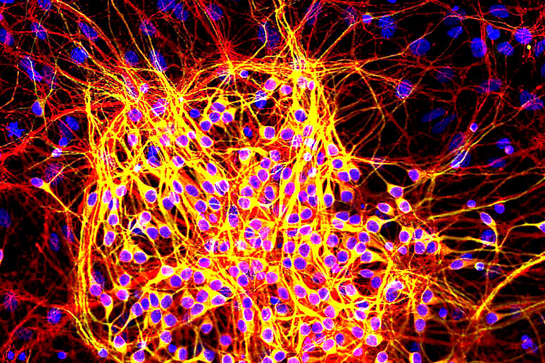Neuroni fatti sviluppare in coltura con la proteina Map2 (fonte: GerryShaw, Wikipedia) - RIPRODUZIONE RISERVATA