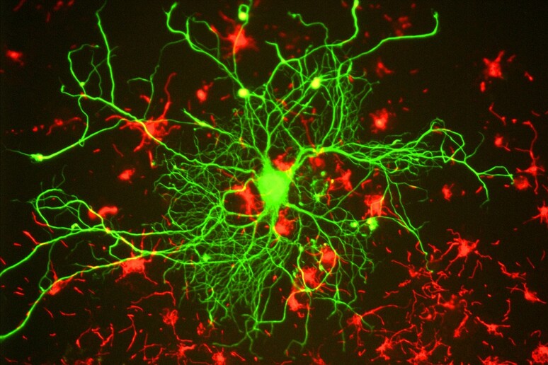 Neuroni motori (fonte: Gerry Shaw, Wikimedia Commons) - RIPRODUZIONE RISERVATA
