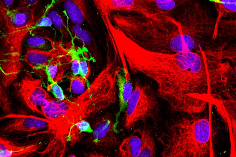 In verde le cellule progenitrici degli oligodendrociti (fonte: Oleg Tsupykov, CC BY-SA 4.0) - RIPRODUZIONE RISERVATA