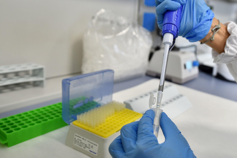 Coronavirus:nuovo laboratorio Piemonte,2mila test al giorno - RIPRODUZIONE RISERVATA