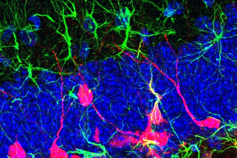 Immagine al microscopio a fluorescenza di neuroni neoformati (fonte: Meritixell Pons-Espinal) - RIPRODUZIONE RISERVATA