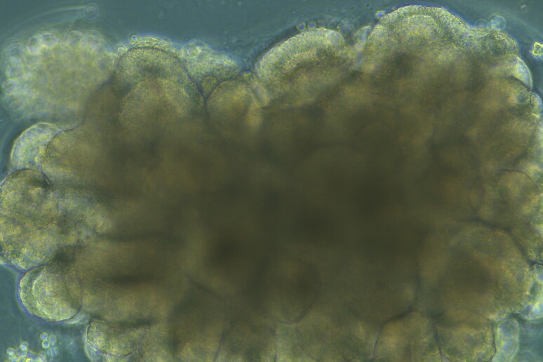 Un organoide del cervello (fonte: National Institute of Allergy and Infectious Diseases, NIH da Flickr) - RIPRODUZIONE RISERVATA