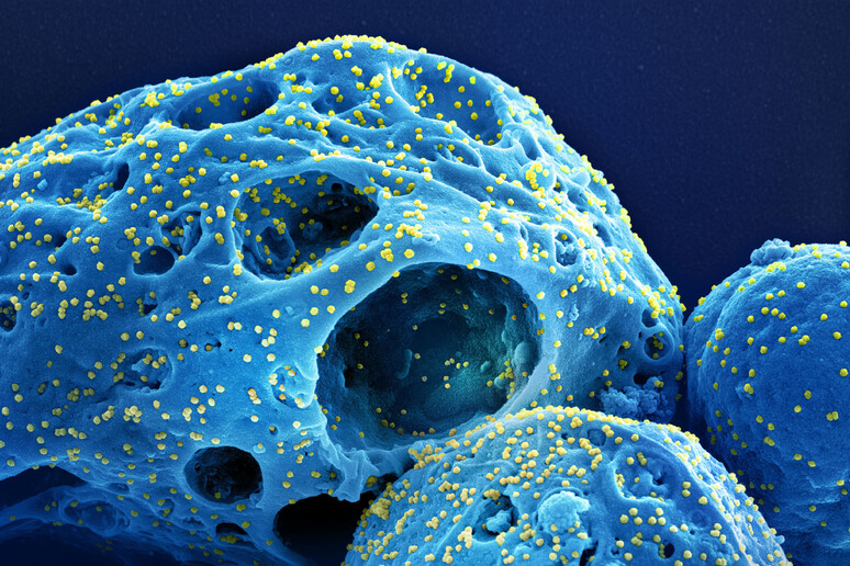In giallo le particelle della variante Omicron del virus SarsCoV2 sulla superficie di una cellula (fonte: NIAID) - RIPRODUZIONE RISERVATA