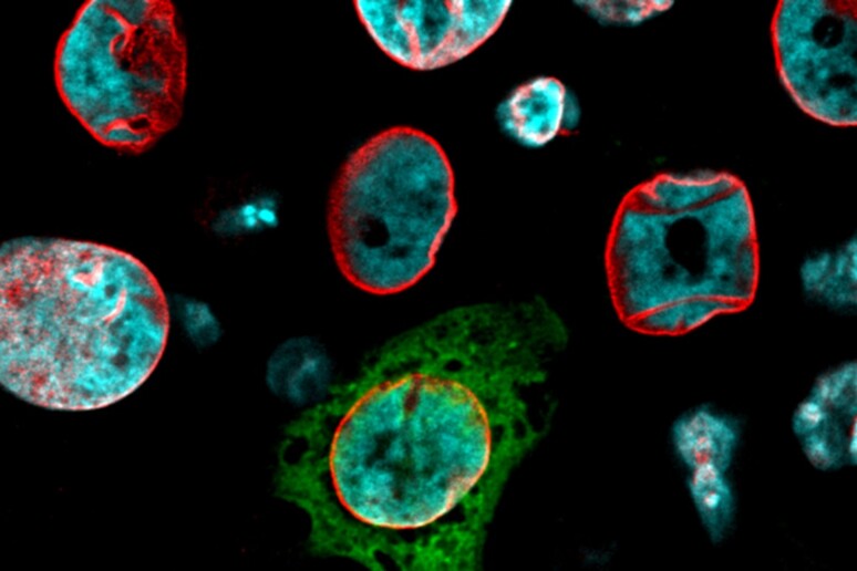 Le cellule tumorali possono passare dallo stato solido a quello liquido, più pericoloso (fonte: IFOM / Università degli Studi di Milano) - RIPRODUZIONE RISERVATA