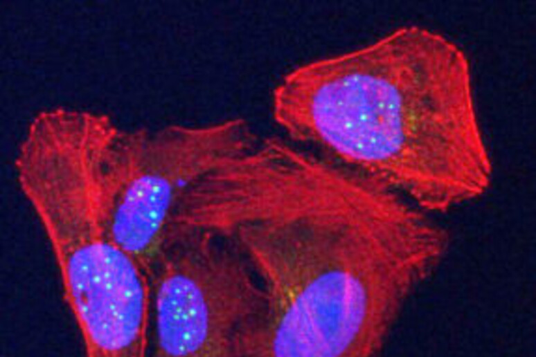 La proteina telomerica VR (sfere verdi) recentemente scoperta si accumula nei nuclei (ovale blu) nelle cellule tumorali dell 'osteosarcoma umano colorate in rosso. (Laboratorio Griffith) - RIPRODUZIONE RISERVATA