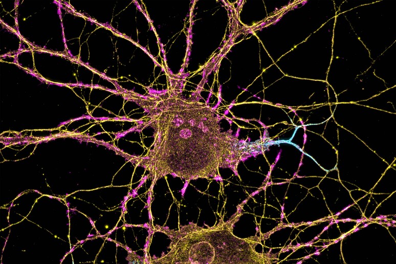 Cellule nervose (fonte: Leterrier, NeuroCyto Lab, INP, Marseille, France) - RIPRODUZIONE RISERVATA