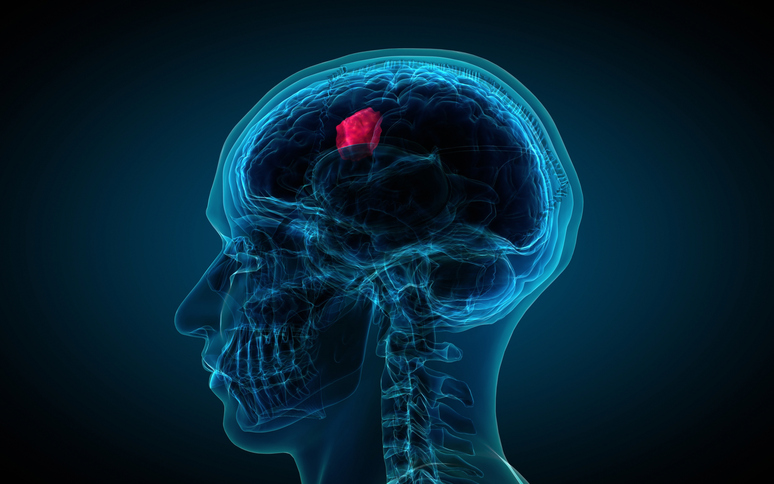 Per il tumore al cervello nuove terapie - RIPRODUZIONE RISERVATA