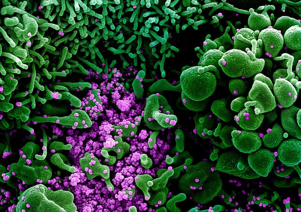 Particelle del virus SarsCoV2 (in violetto) sulla superficie di una cellula (fonte: NIAID) © Ansa