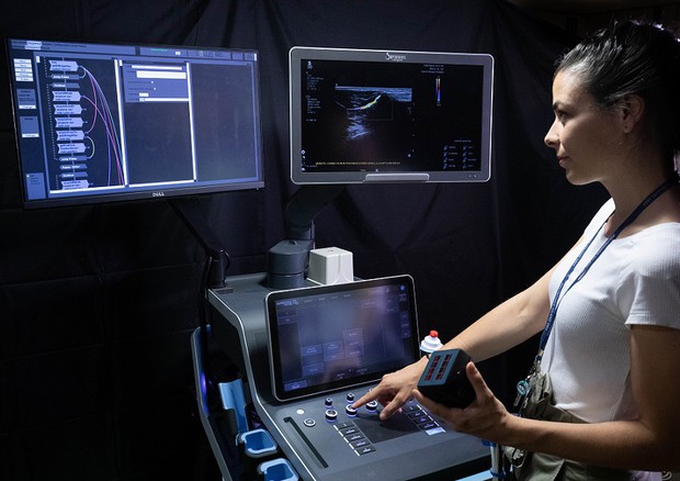 Il sistema di imaging tomografico multimodale sviluppato dal progetto SOLUS (fonte: Politecnico di Milano) © Ansa