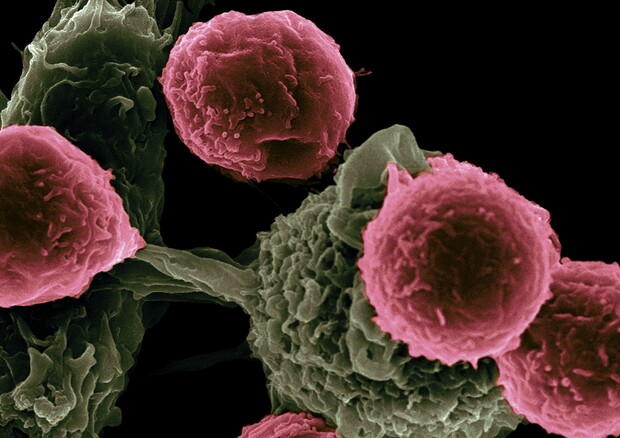 Cellule tumorali (fonte: National Cancer Institute da Unsplash) © Ansa