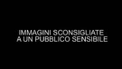 Bergamo, deputato Lega documenta intervento con il taser(ANSA)
