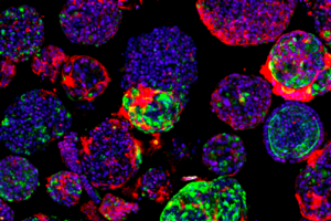 Organoidi del fegato coltivati in laboratorio aiutano a studiare i tumori del fegato. In verde le cellule staminali tumorali (fonte: Benedetta Artegiani / Princess Máxima Center for pediatric oncology) (ANSA)