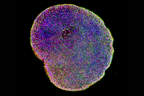 Un organoide del cervello umano (fonte: Paola Arlotta laboratory, Harvard University)
