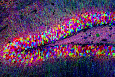 Cellule del cervello di topo (fonte: Tamily Weissman, Harvard University)