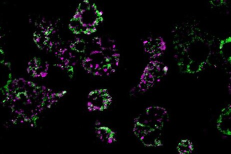 Mitocondri delle cellule adipose (fonte: UC San Diego Health Sciences)
