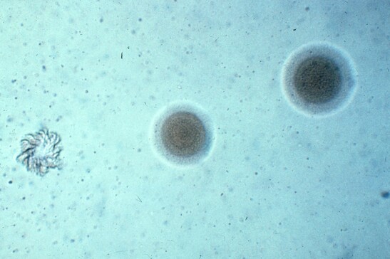 Il mycoplasma pnaumoniae è uno degli indiziati per i focolai di polmoniti in Cina (fonte: NIAID, CC BY-NC-SA 2.0)