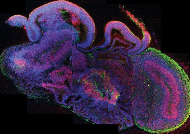 Un organoide cerebrale  (fonte: IMBA/Lancaster via Wikipedia) (ANSA)