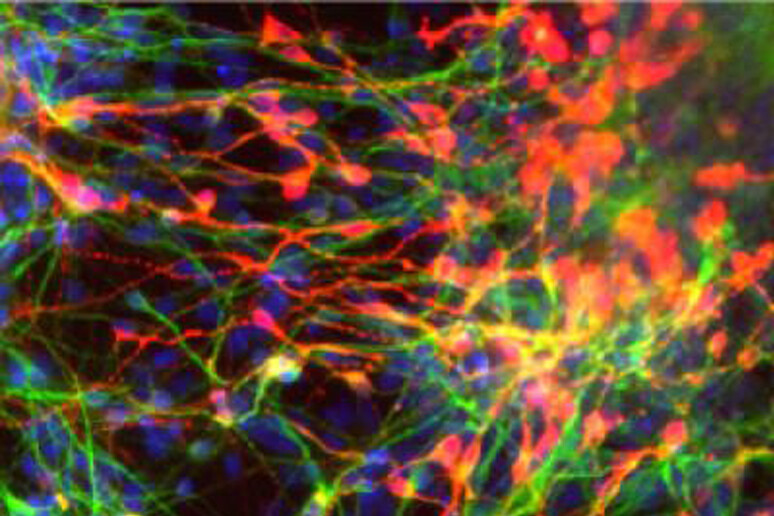 Cellule staminali adulte del cervello (fonte: UC San Diego School of Medicine) - RIPRODUZIONE RISERVATA