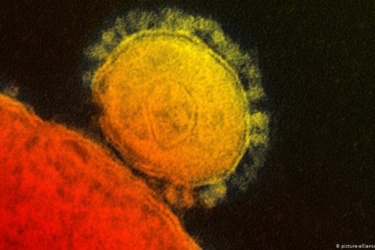 Il coronavirus visto al microscopio elettronico (fonte: NIAID-RML) - RIPRODUZIONE RISERVATA
