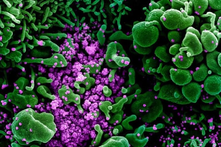 In violetto le particelle di SarsCoV2 durante un 'infezione, viste al microscopio elettronico (fonte: NIAID-RML) - RIPRODUZIONE RISERVATA
