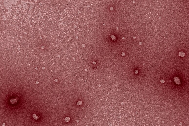 Immagine al microscopio elettronico delle nanoparticelle utilizzate per stimolare il sistema immunitario contro i tumori (fonte: Nicki Watson, W. M. Keck Microscopy Facility/Whitehead Institute, colorazione da MIT News) - RIPRODUZIONE RISERVATA