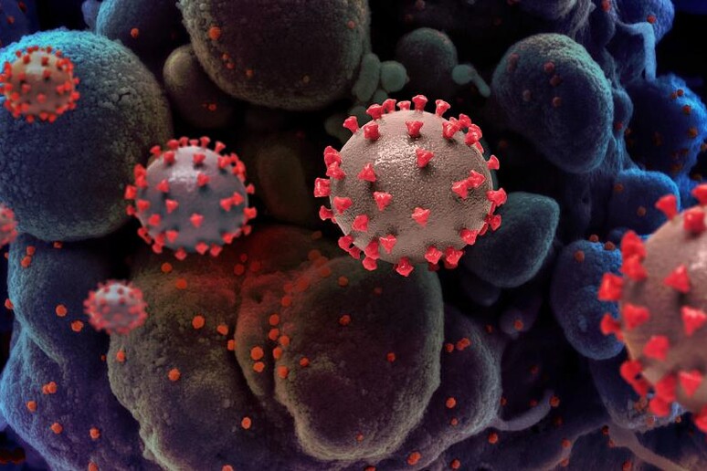 Rappresentazione artistica di particelle del virus SarsCoV2 (fonte: NIAID) - RIPRODUZIONE RISERVATA